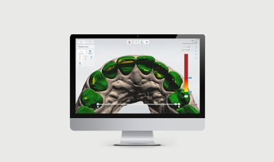 Dental System software teeth modeling